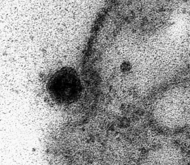 Koronavirus sağlam hüceyrələrə belə hücum edir - FOTOLAR